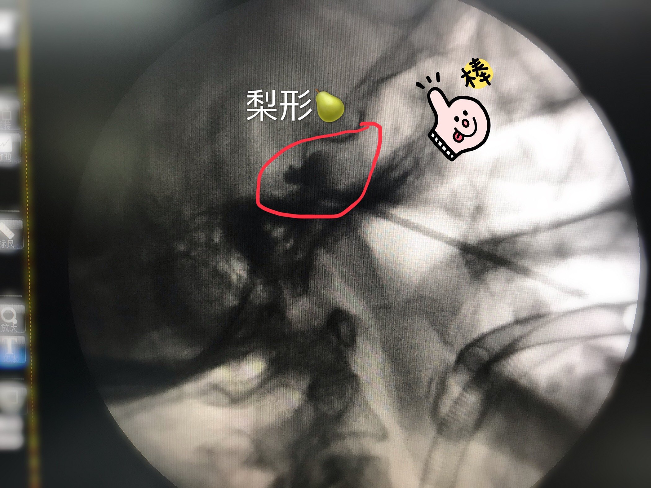 暂无