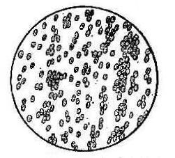 在没排卵的女性镜下呈现羊齿状结晶,而排卵后分泌物变成了椭圆体