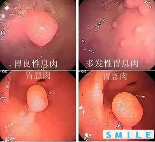 圖文圖片