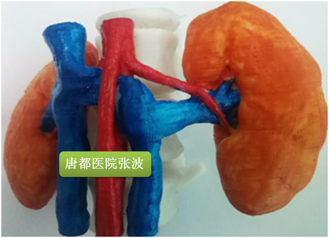 胡桃夹综合征10问 胡桃夹综合征 治疗方法 胡桃夹综合征10问 胡桃夹综合征 治疗方法