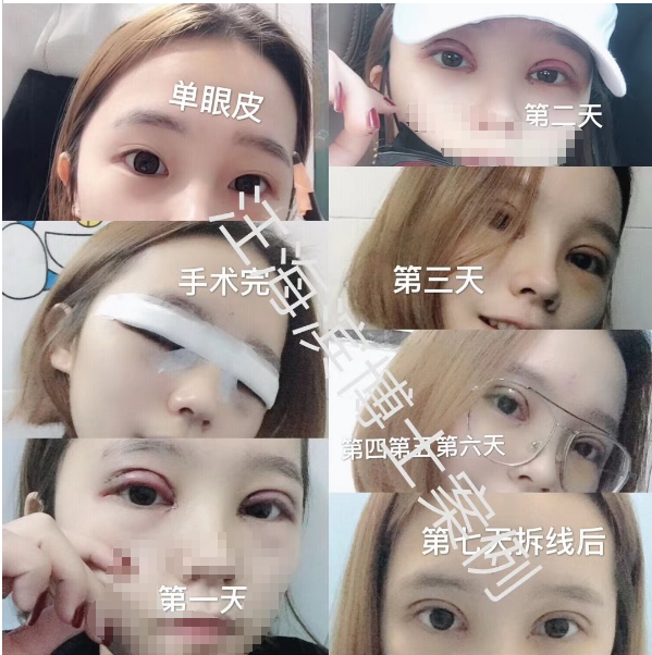 暂无