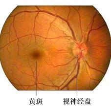 眼睛不好 黄斑疾病 眼底病变 儿童近视 多吃什么食物好呢 近视