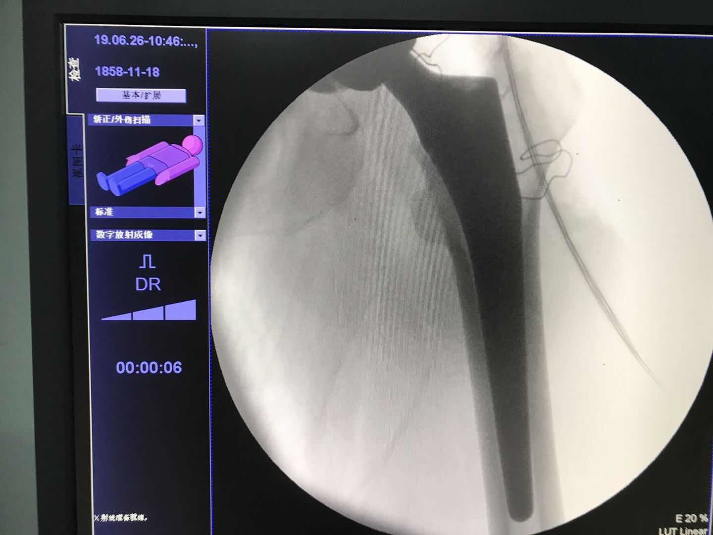 擅長:成人發育性髖關節發育不良、DDH人工關節置換術、運動醫學。號販子電話,圈子口碑最好100%有號!的簡單介紹 擅長:成人發育性髖關節發育不良、DDH人工關節置換術、運動醫學。號販子電話,圈子口碑最好100%有號!的簡單介紹
