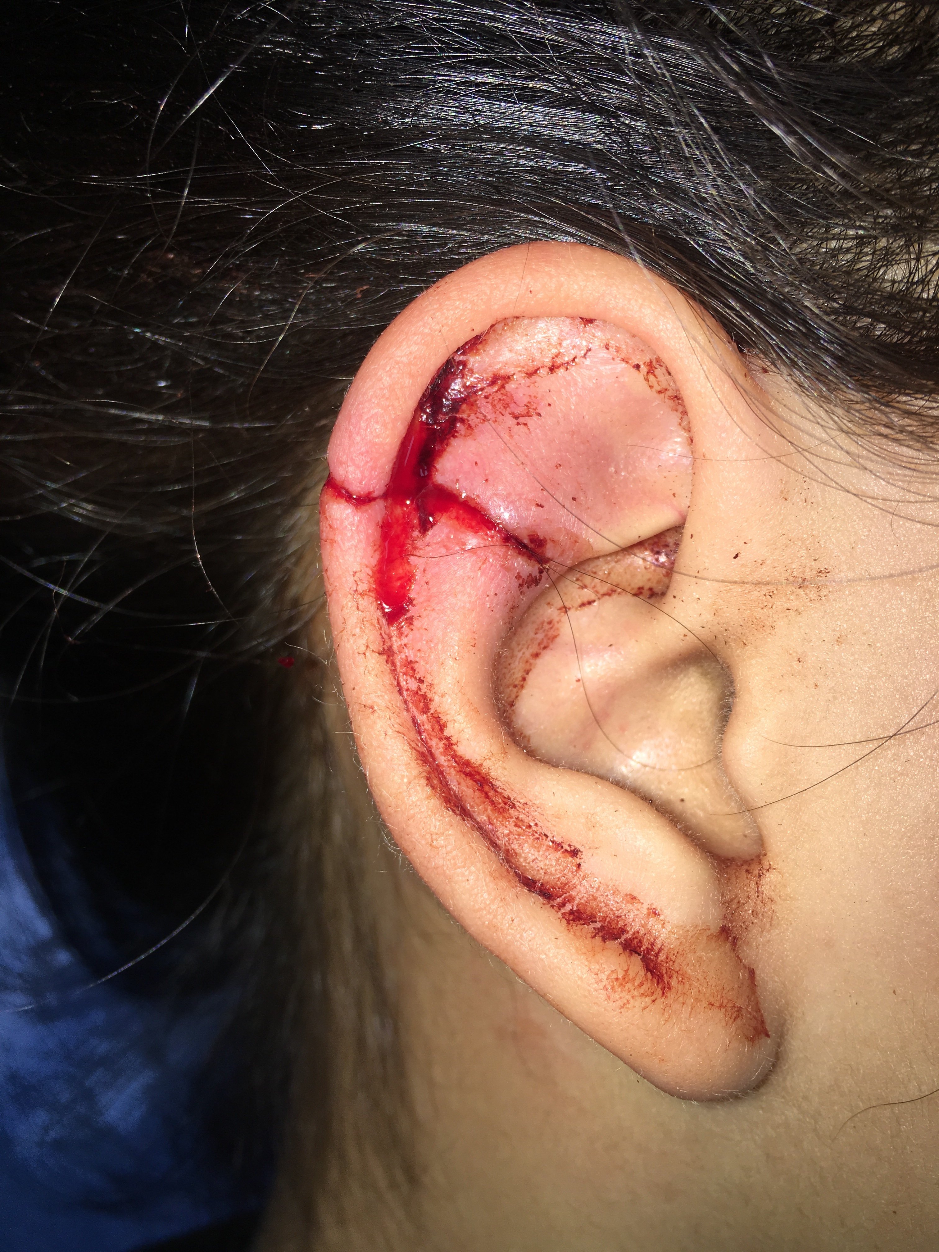 面部外伤整形外科急诊清创缝合 - 好大夫在线