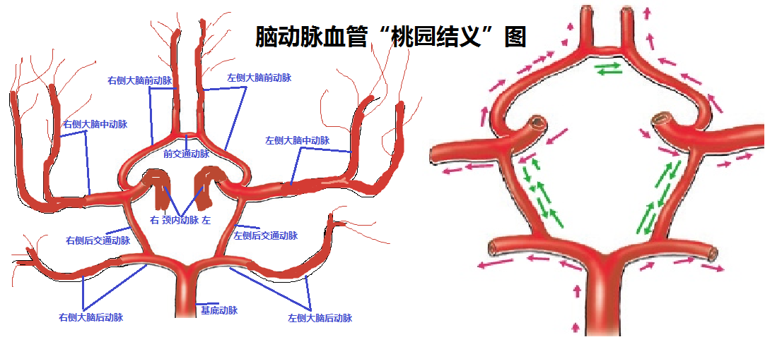 如前文所述,脑部各动脉之间通过前交通动脉,后交通动脉相互连接形成了