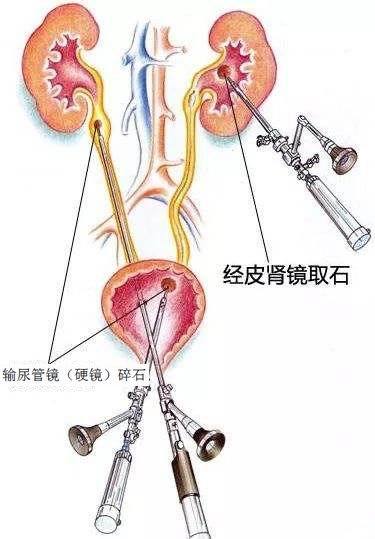 暂无
