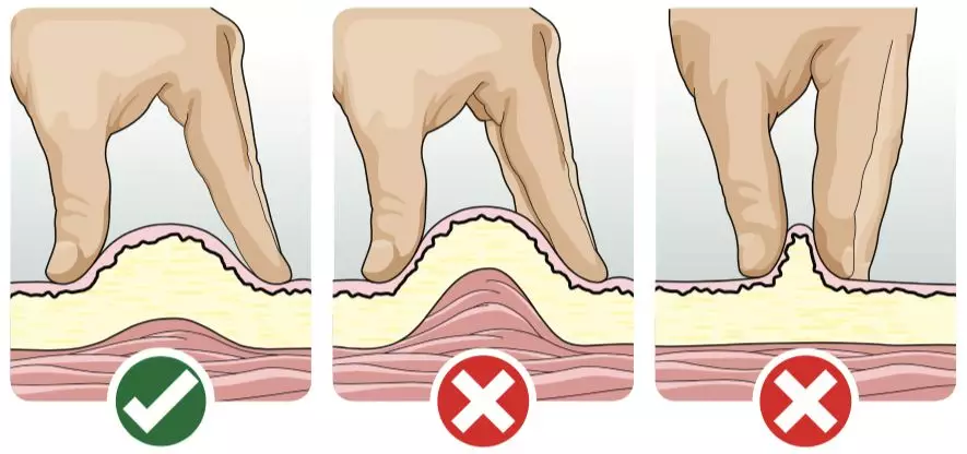 4,进针的角度,针头长度不同,进针角度也要不同.