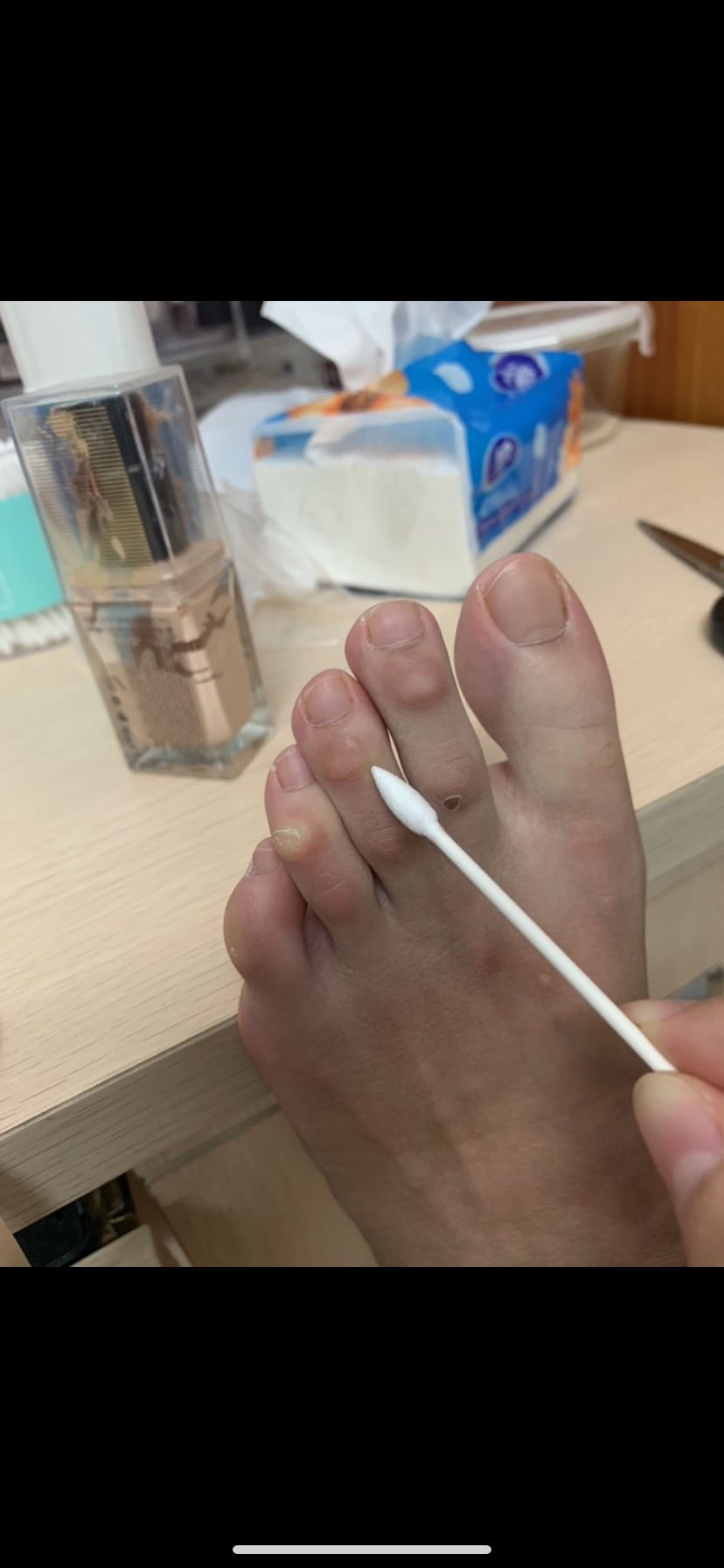 手指关节背部皮肤越来越厚,越来越硬,这是什么?