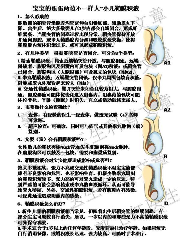 宝宝的蛋蛋两边不一样大~小儿鞘膜积液