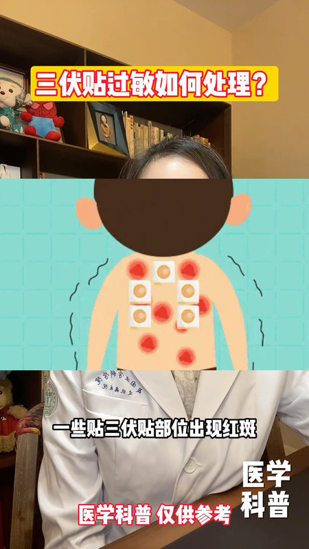 三伏贴过敏如何处理？