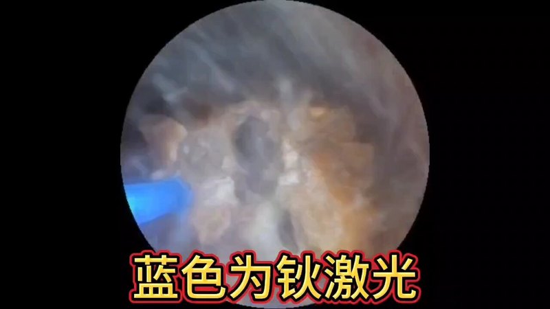 視頻封面