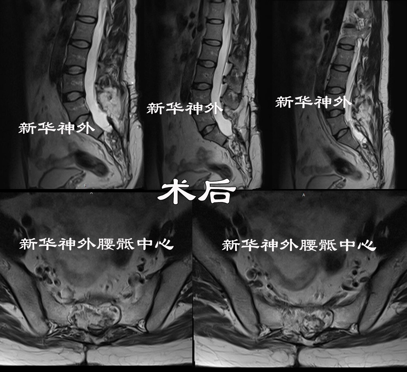 图13 骶骨（后面观）-人体解剖组织学-医学