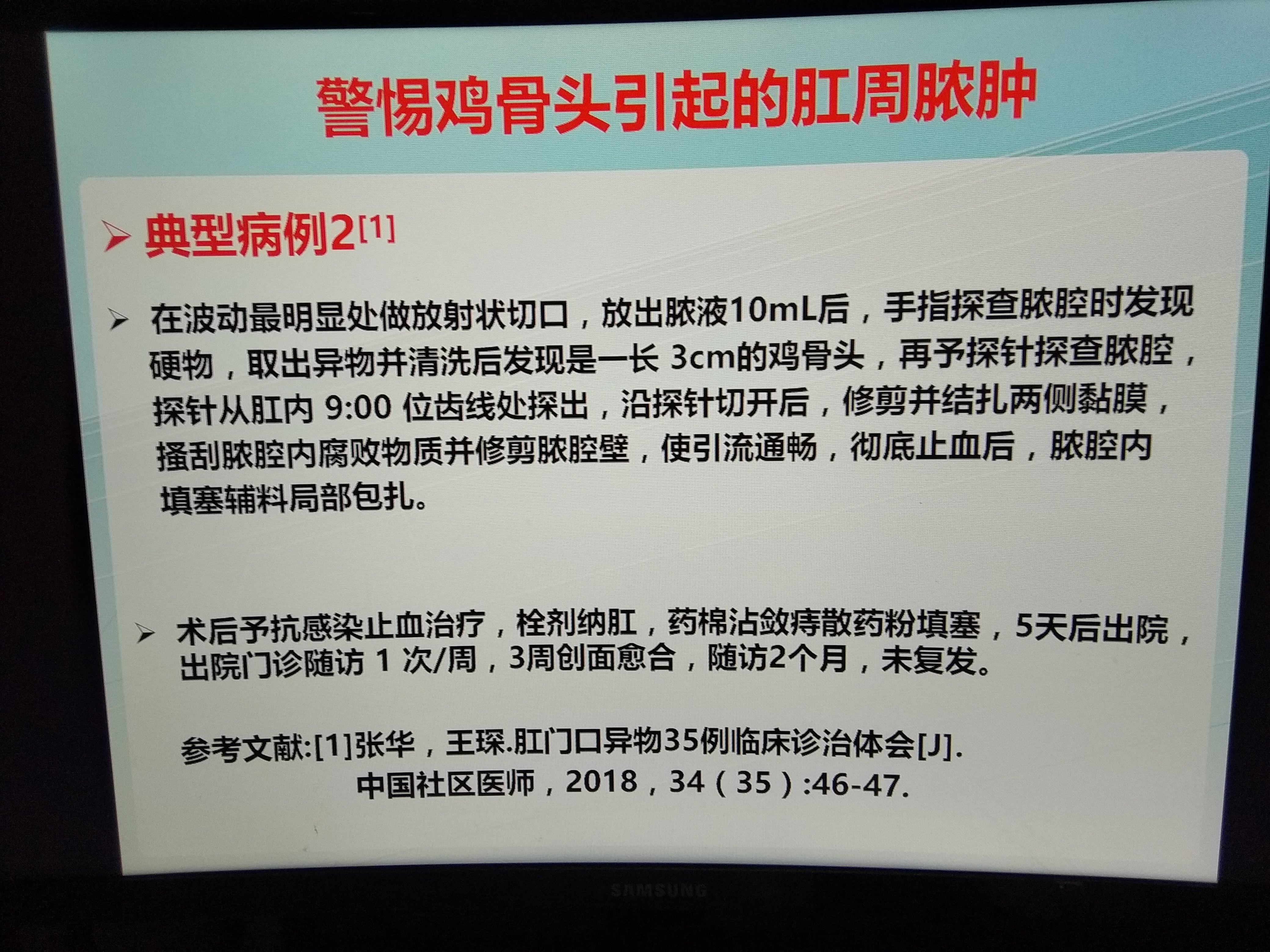 棗核卡在肛門口,外痔充血水腫,肛門疼痛難忍