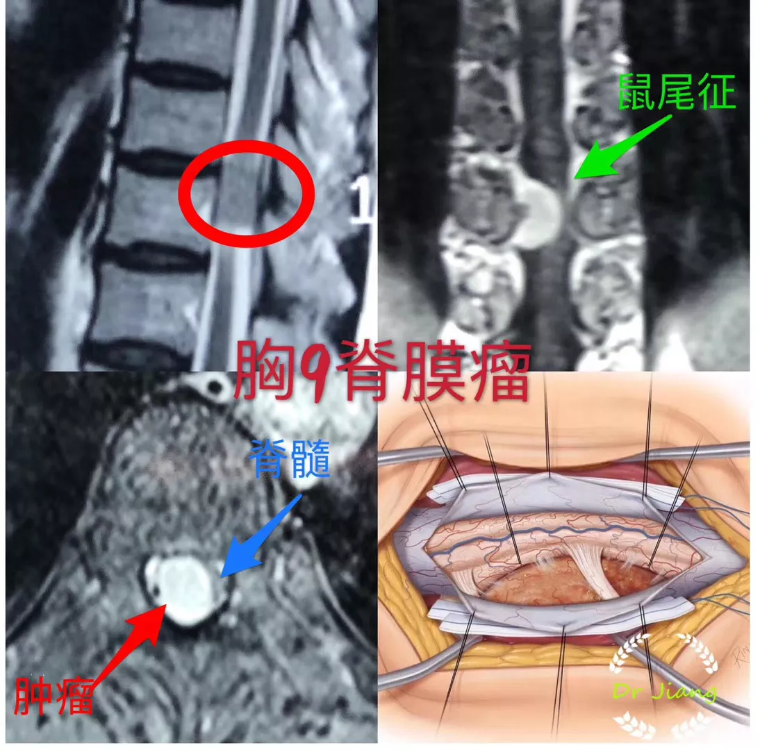 暂无