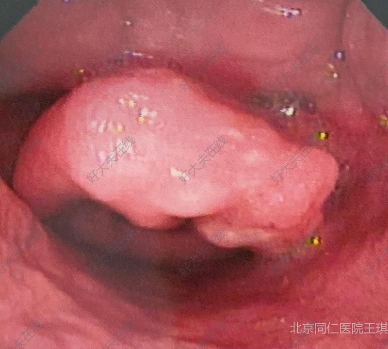 圖文圖片