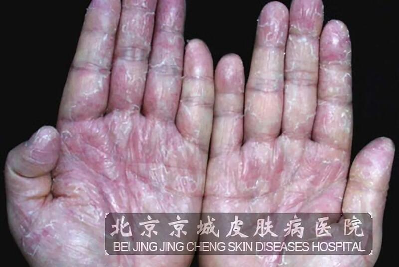 圖文圖片