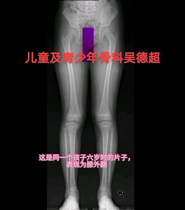 視頻封面