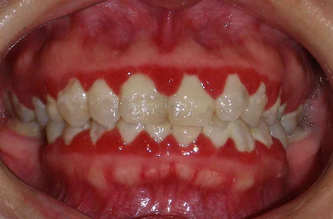牙周健康的原理2