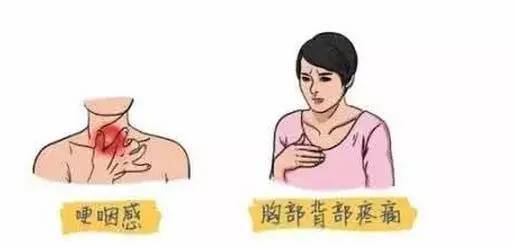 食管癌(esophageal cancer)原發於食管黏膜上皮的惡性腫瘤,主要為鱗癌