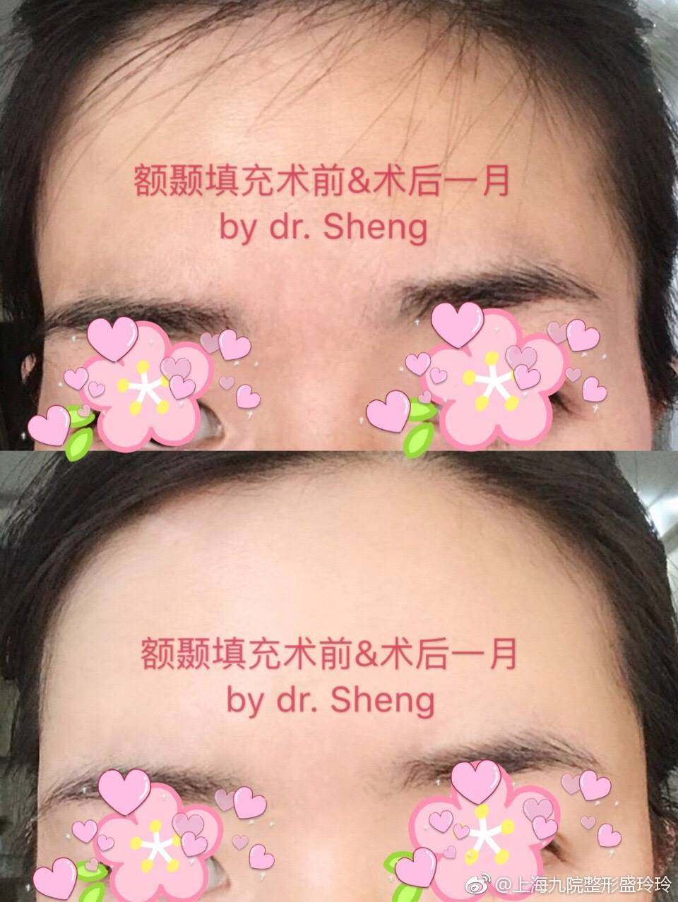 暂无