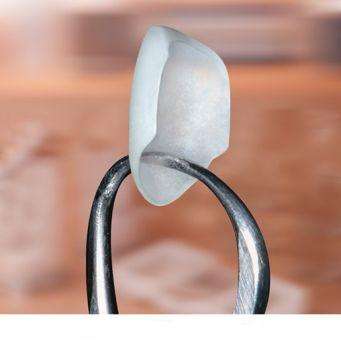 瓷贴面修复的优点是牙齿磨除量小,只相当于常规烤瓷修复的1/2左右