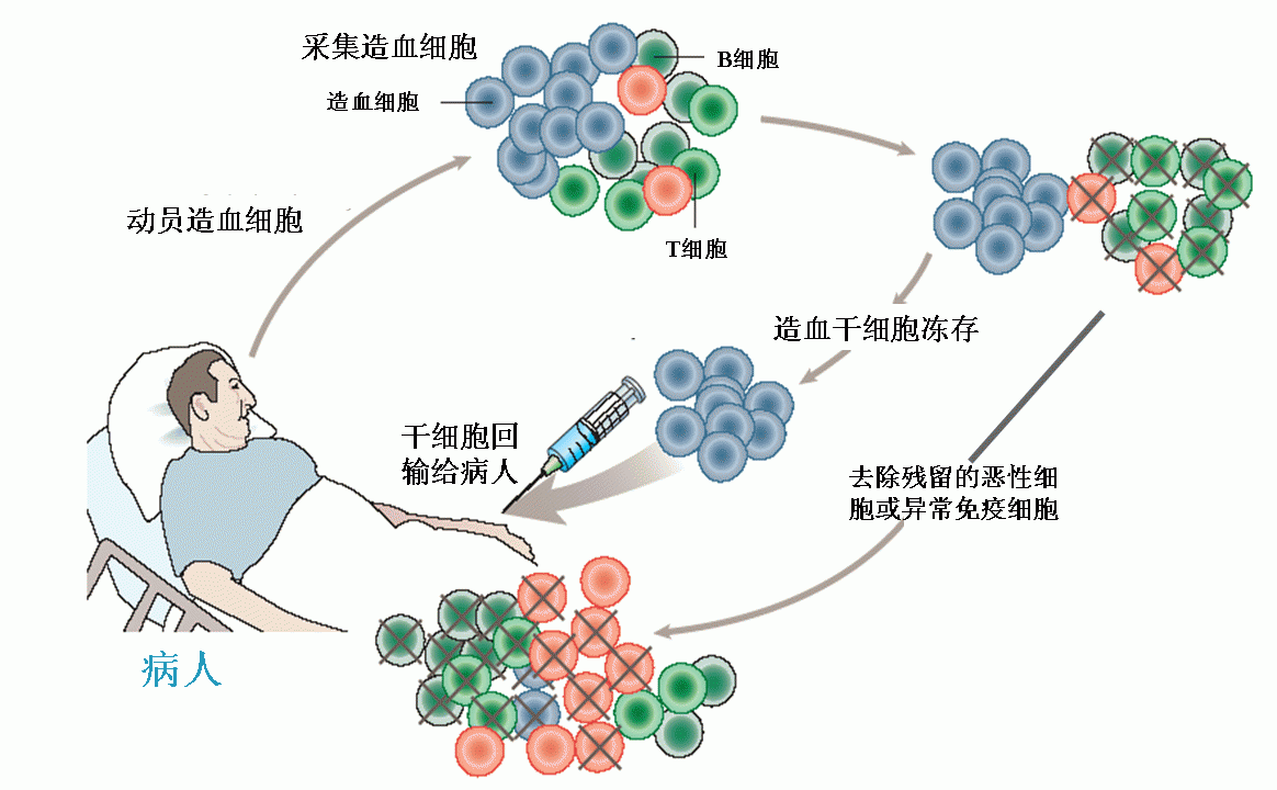 浅谈造血干细胞移植一