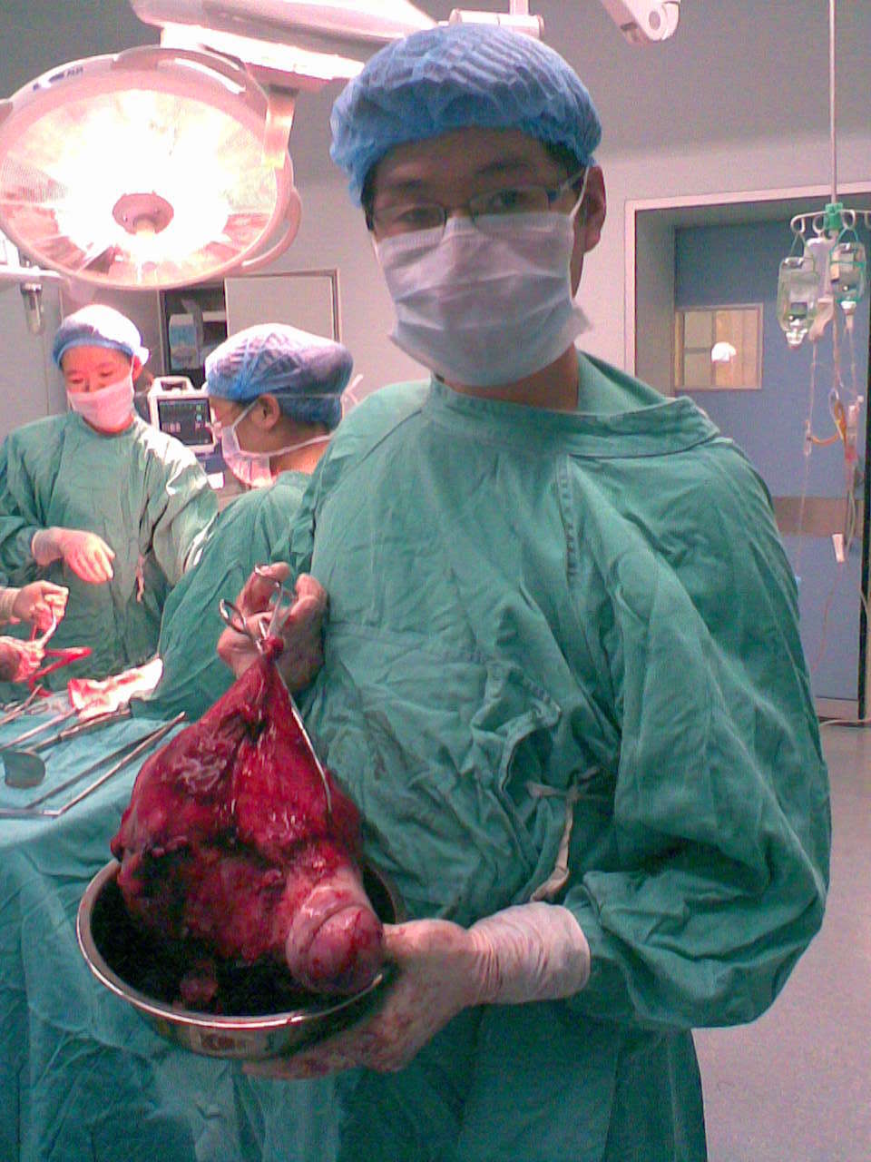 7.腹腔镜子宫次切术,顺利.—2012.9.256.tcrf,顺利.5.