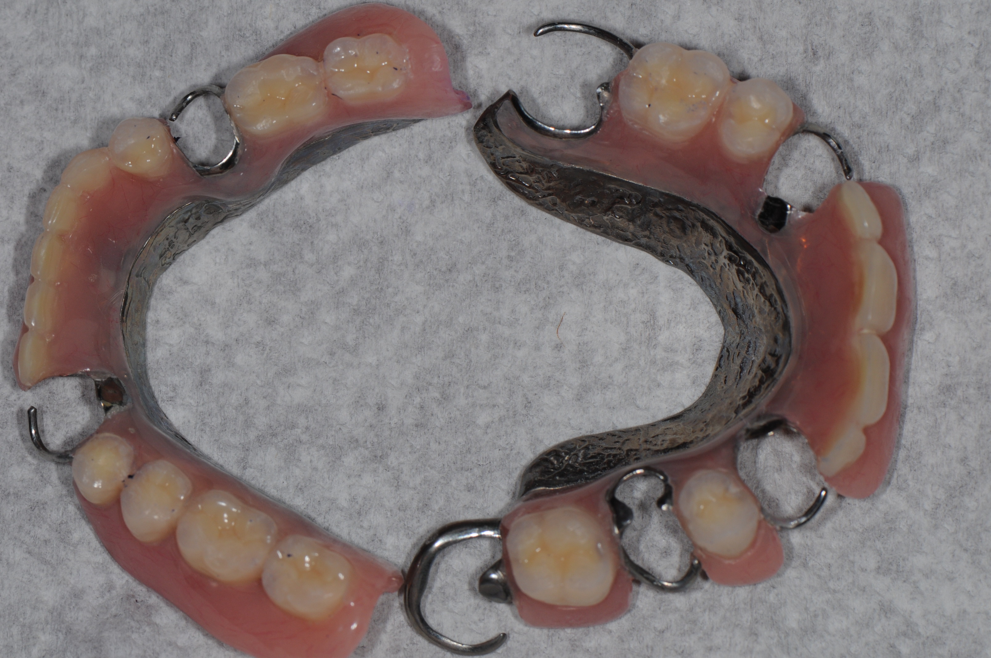 纯钛活动牙支架的图片图片