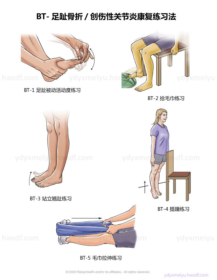 bt足趾骨折創傷性關節炎康復練習法