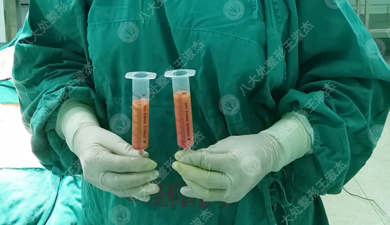 wIYBAFtO1nmAAK1pAAFSLqbi6G0654.jpg?_ms_=cea0