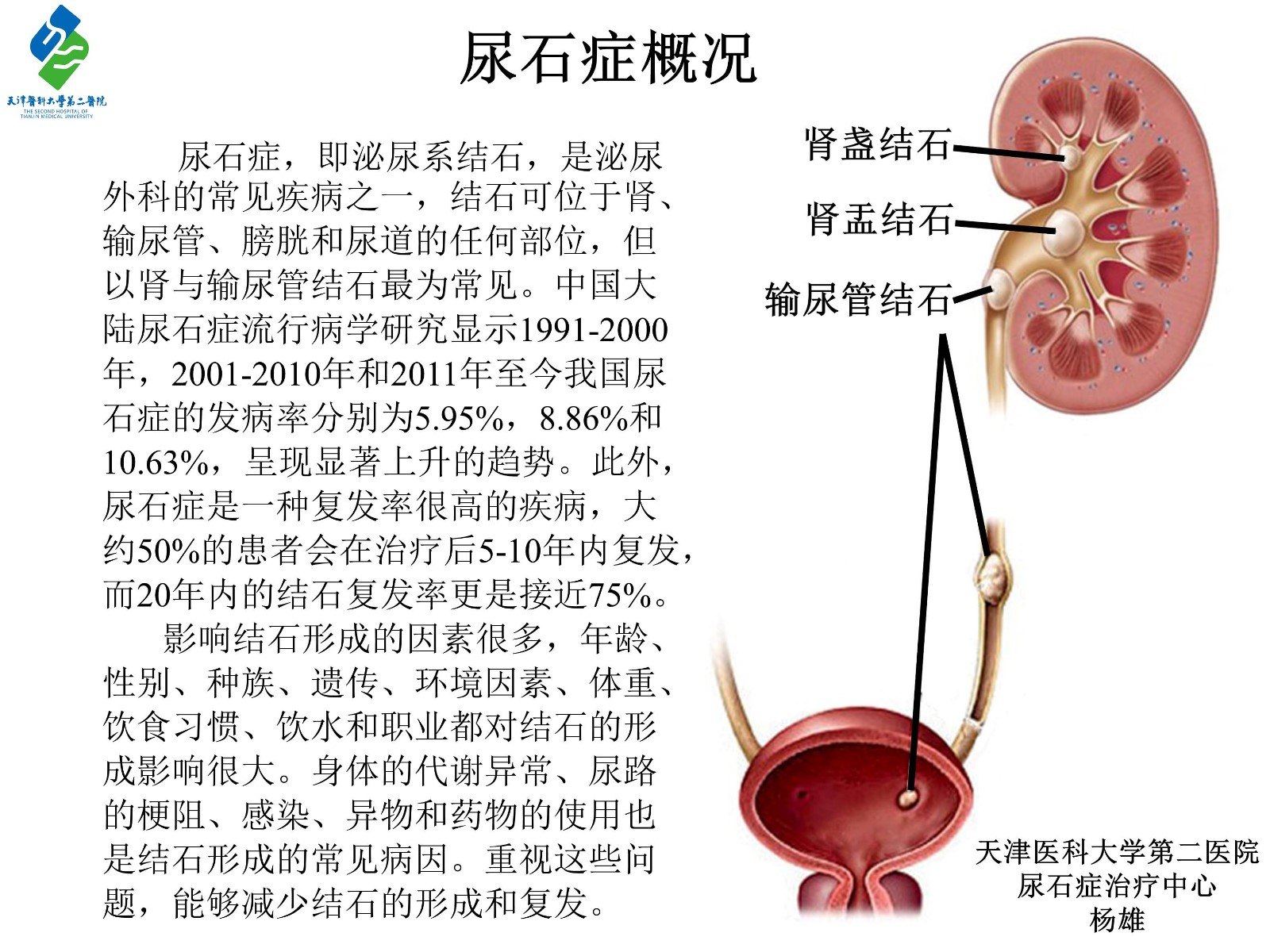 尿石症概述