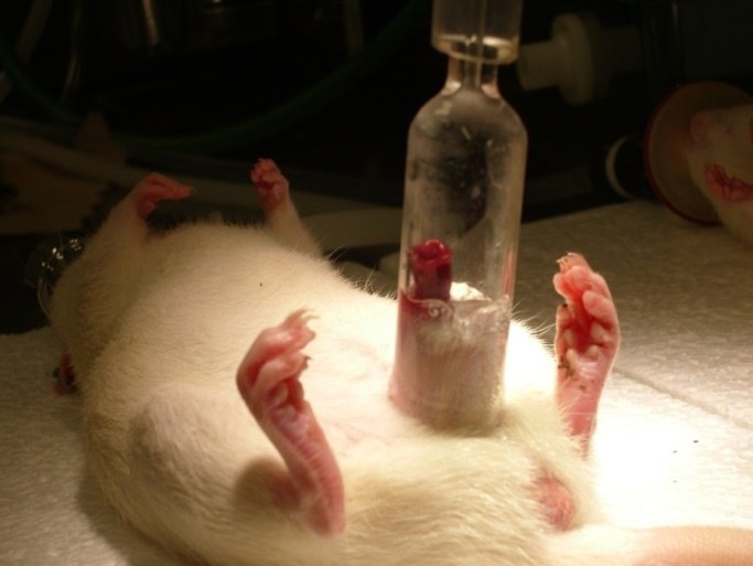 「阳痿」的无创疗法:负压吸引助你"吸走"了你的「勃起功能障碍」