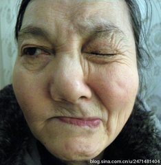 皱眉肌 yoYBAFs9v0yAA1WNAAAy_rStWRM816.jpg?_ms_=f8f7