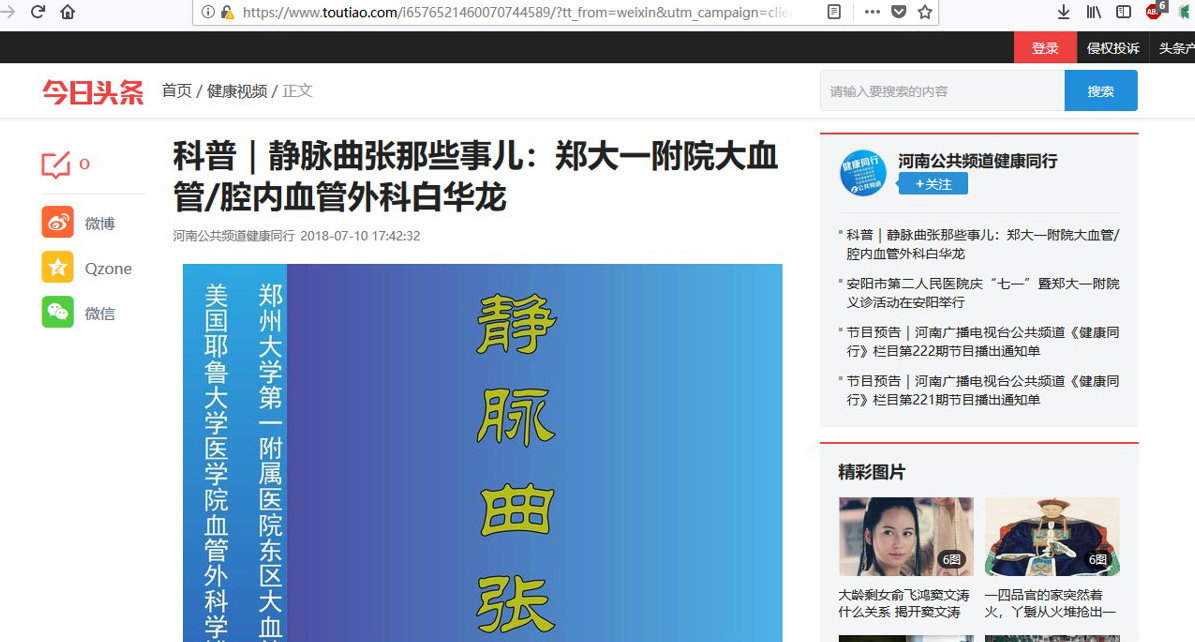 静脉曲张那些事儿---河南电视台公共频道推荐