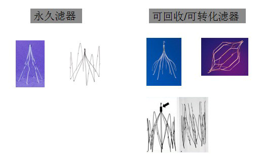 1531723265963608.png 滤器的种类.png