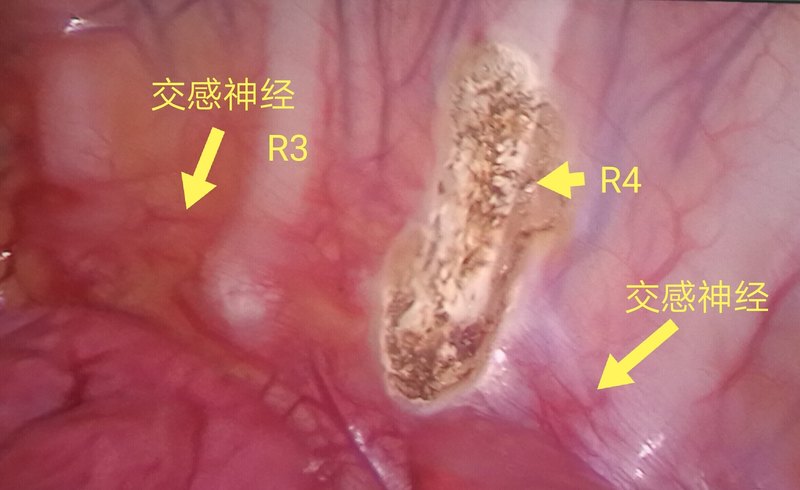 圖文圖片