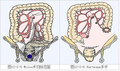 u=3617118321,191343069&fm=26&gp=0.jpg