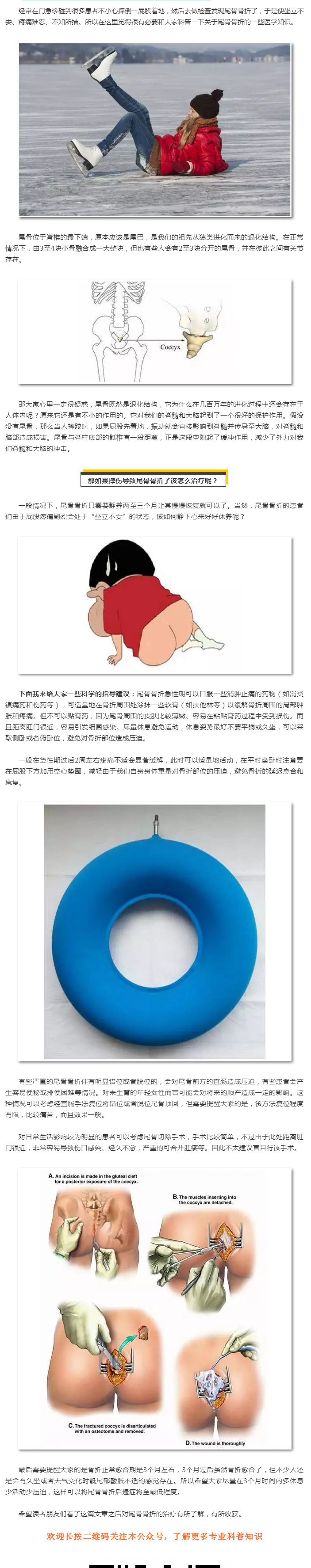 尾骨骨折了该怎么办 脊柱骨折 脊柱骨折