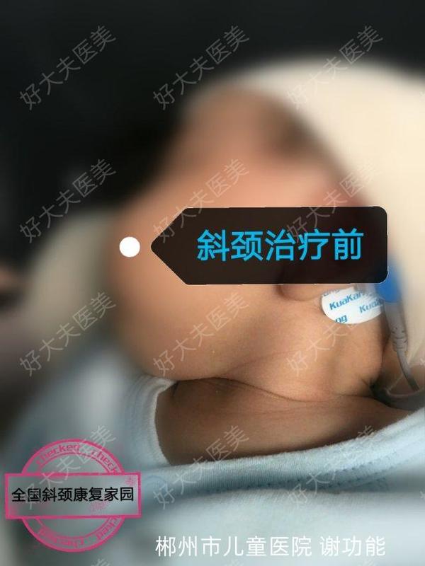 圖文圖片