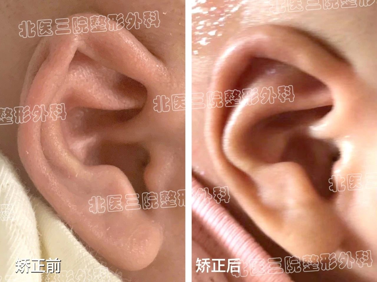 唐宝宝耳朵结构图片图片
