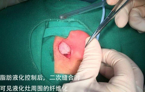 圖文圖片