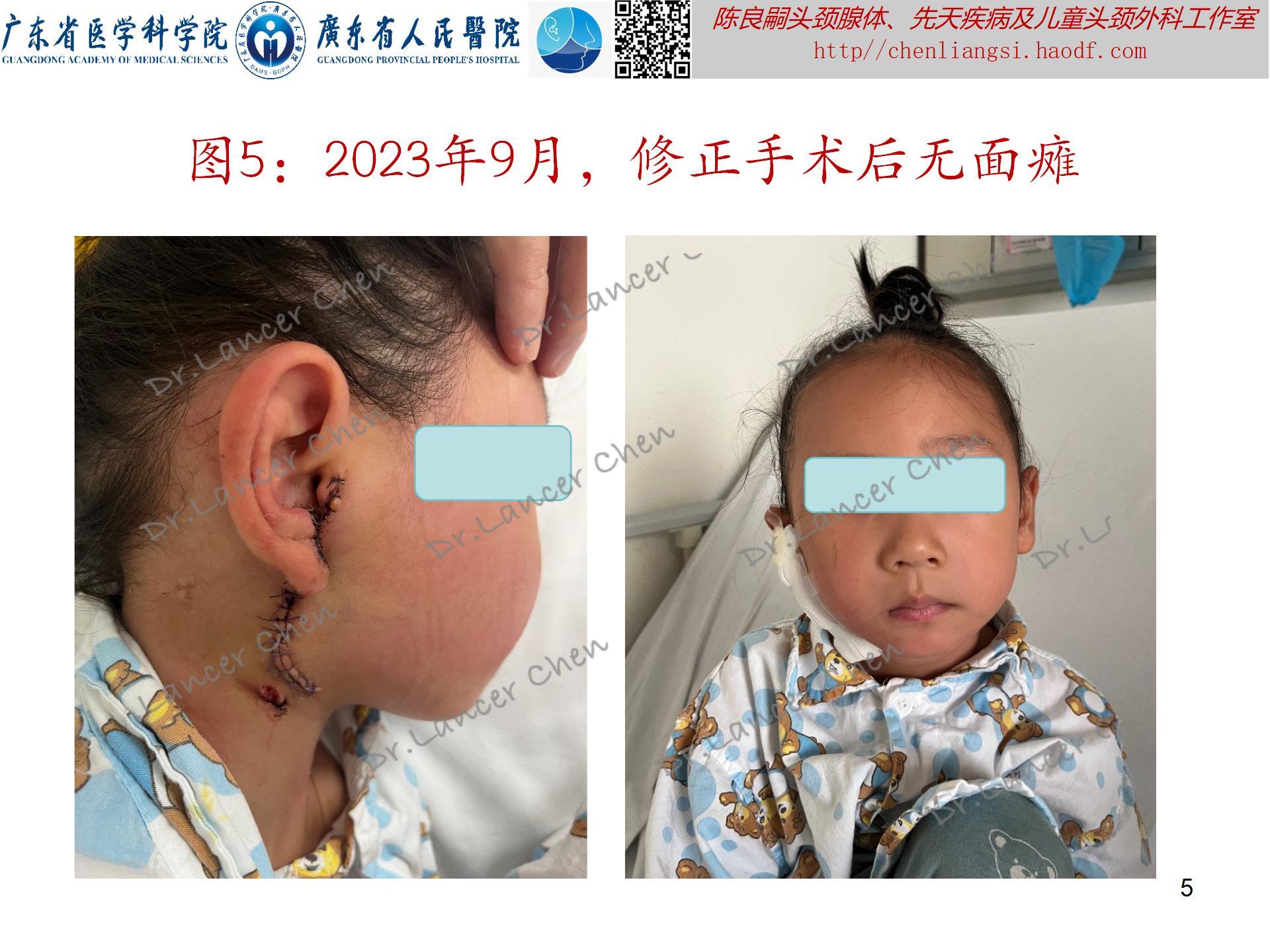 什么手术需要解剖 yoYBAGaGrl2AWAaiAARF4N30kEk714.jpg?_ms_=0213