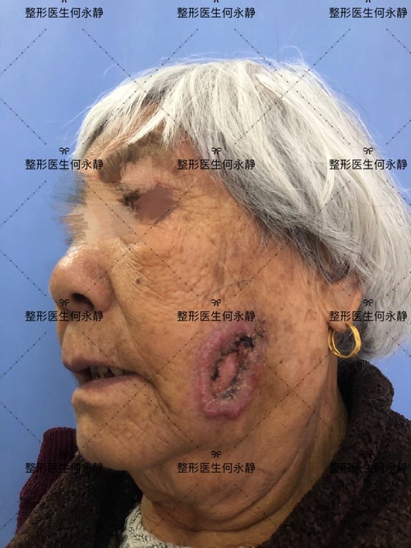 圖文圖片