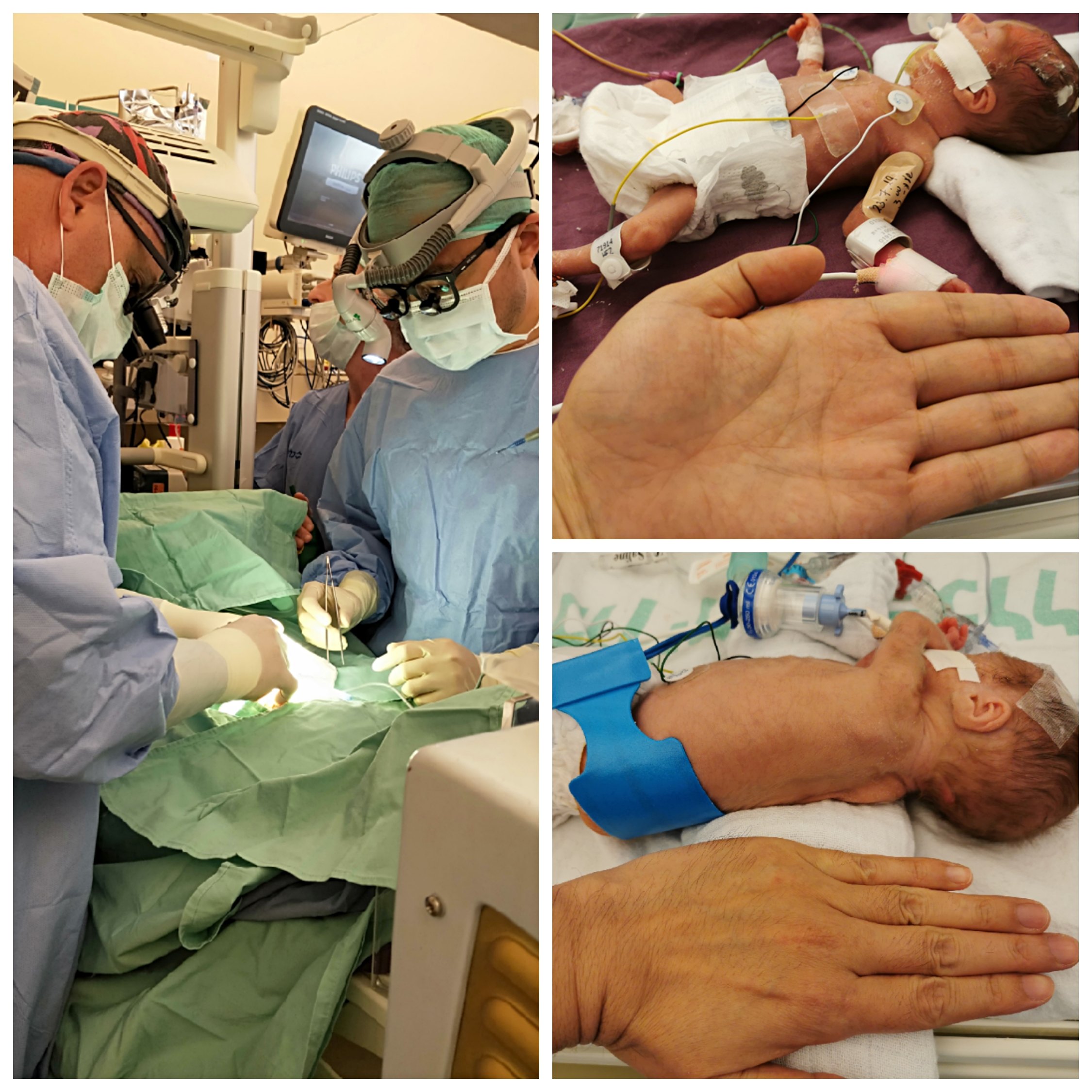 以色列儿童医学中心【复杂性先天性心脏病】学习体会