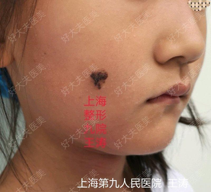 圖文圖片