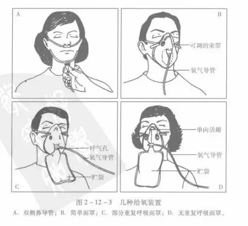 鼻导管的正确戴法图片图片
