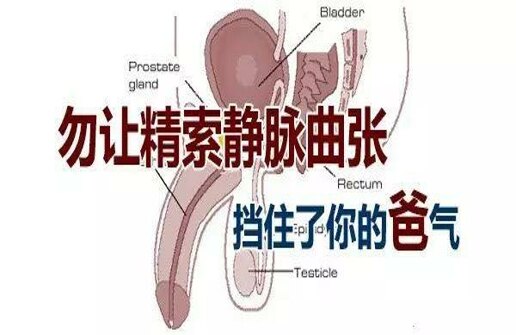 精索靜脈曲張_介紹_治療方式 - 好大夫在線