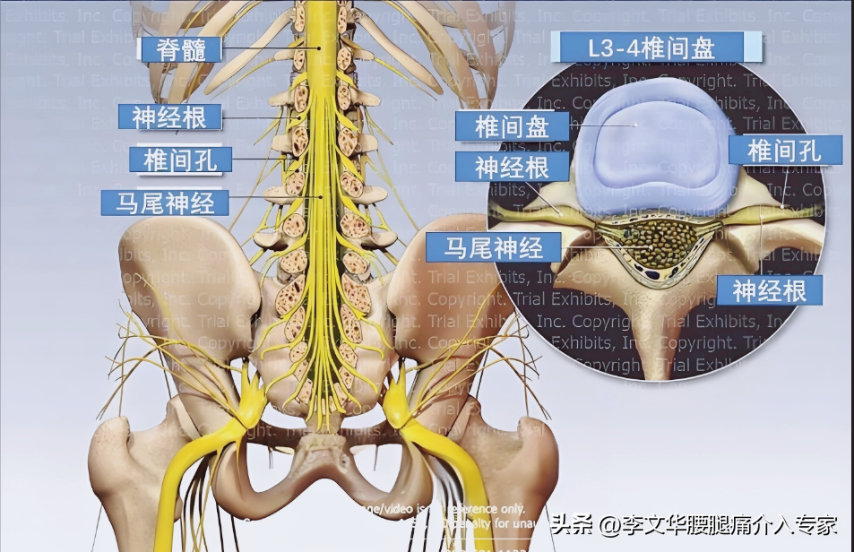医学科普:深度认识你的腰椎间盘Ⅱ_腰椎间盘突出_腰椎间盘突出介绍 - 好大夫在线