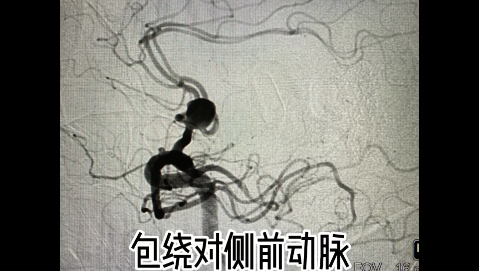 默认图片