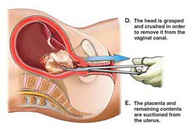 rl-2011-11-18-ljr-04.jpg